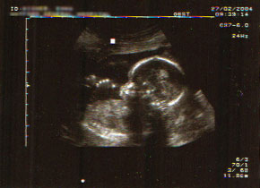 one, two, three, four fingers and one thumb...check!